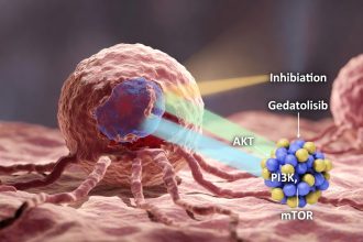 Gedatolisib: Terapi Target Inovatif untuk Kanker Payudara