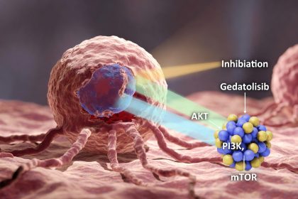 Gedatolisib: Terapi Target Inovatif untuk Kanker Payudara