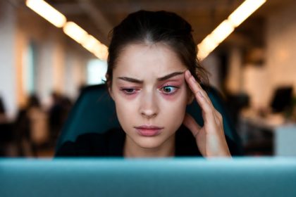 Ilustrasi Wanita dengan Gejala Computer Vision Syndrome