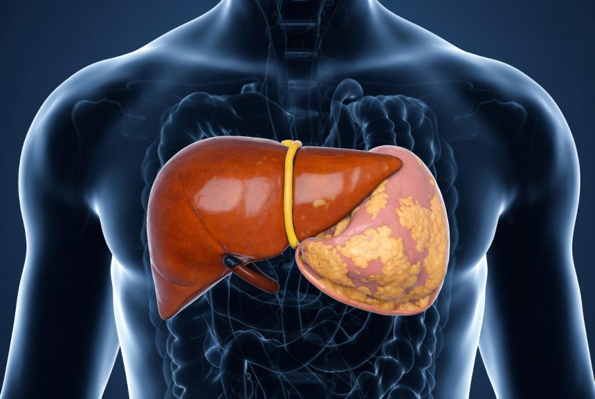 Ilustrasi hati berlemak dengan latar belakang tubuh manusia