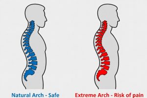 perbedaan-sumber-lengkungan-arch-punggung