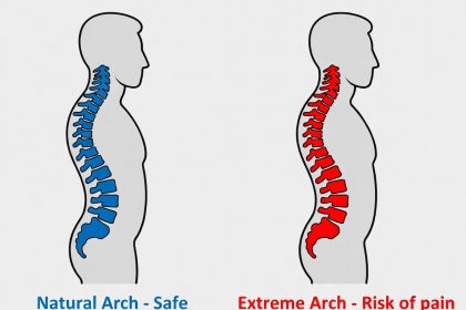 perbedaan-sumber-lengkungan-arch-punggung